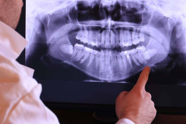 Best Urgent Care for Lost Fillings or Crowns in USA